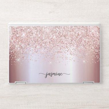 Glam Rose Gold Glitter Monogram Name Luxury Modern HP Laptop Skin